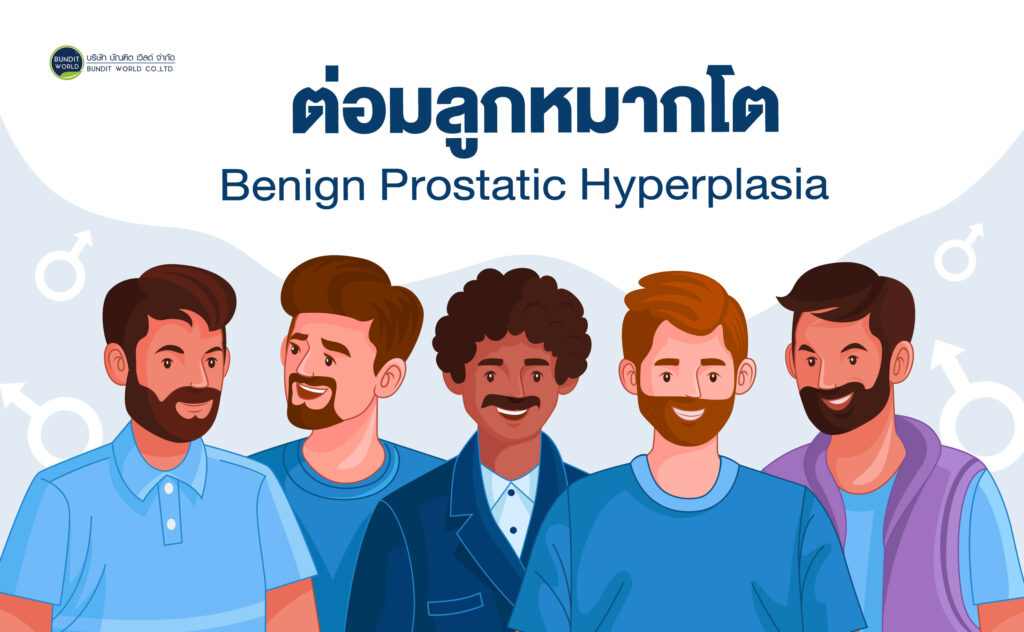 Benign Prostatic Hyperplasia ต่อมลูกหมากโต