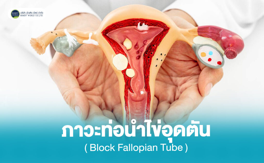 Fallopian Tube Obstruction ภาวะท่อนำไข่อุดตัน