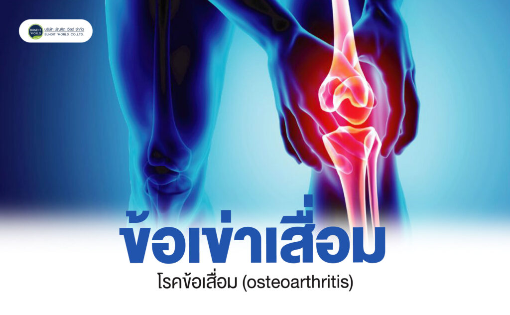 osteoarthritis โรคข้อเสื่อม