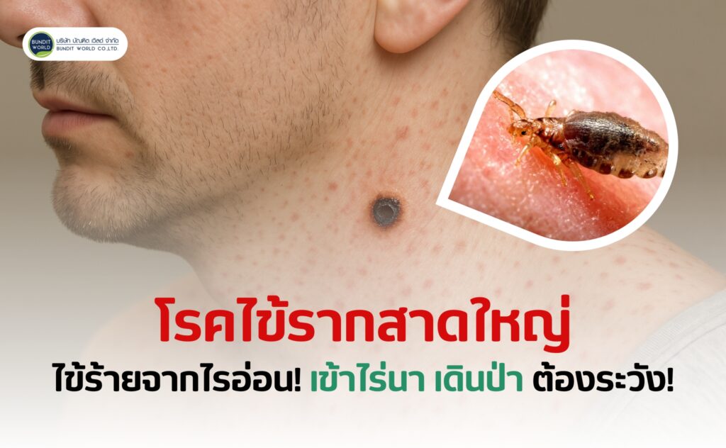 Scrub typhus