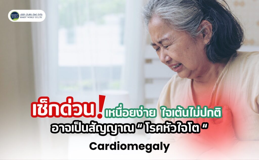 Cardiomegaly