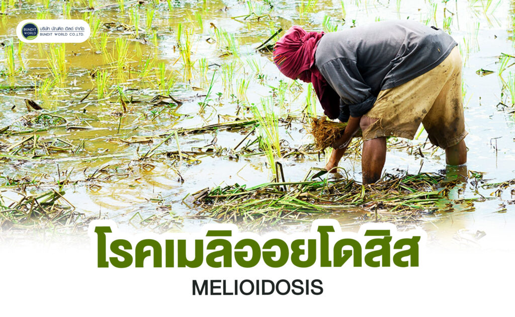 MELIOIDOSIS