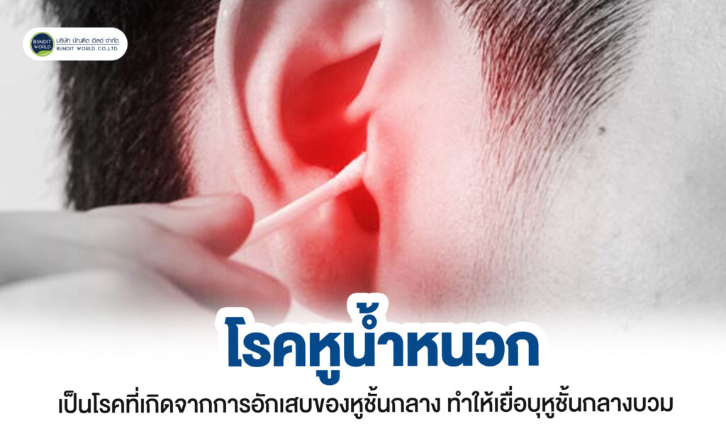 Otitis Media