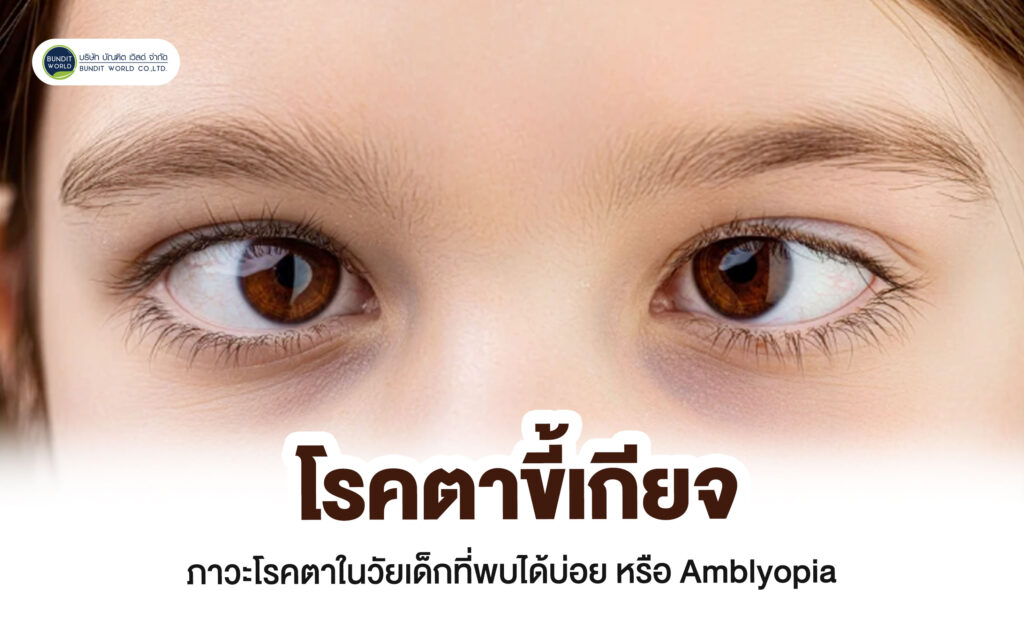 Amblyopia