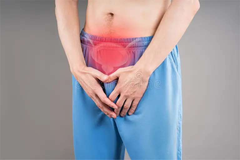 Benign Prostatic Hyperplasia ต่อมลูกหมากโต 